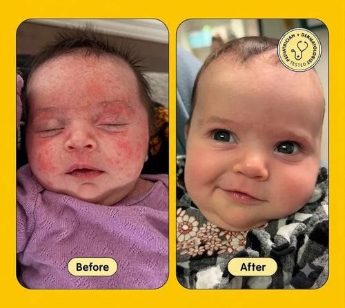 Velune™ Manuka Honey Cream